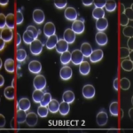 Radiation From Wireless Devices May Cause Breast Cancer, New Study Shows